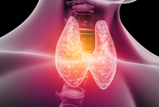 Thyroid-Gland-Surgery